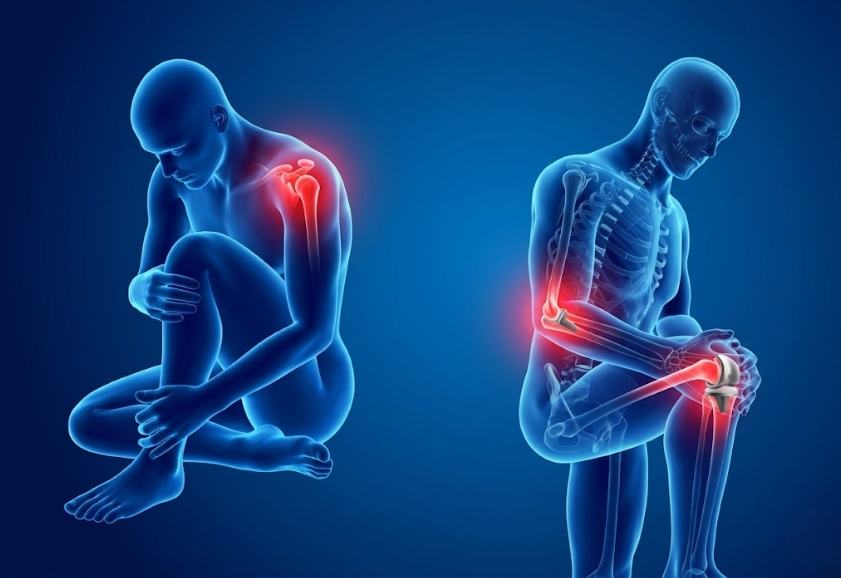 Knee Replacement Surgery